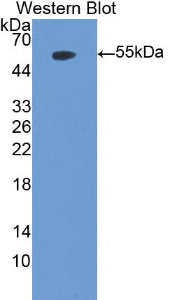 Polyclonal Antibody to Myeloperoxidase (MPO)