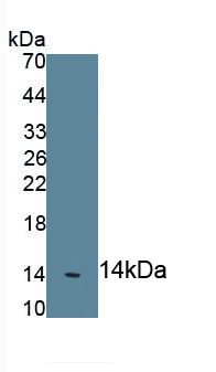 Polyclonal Antibody to Myeloperoxidase (MPO)