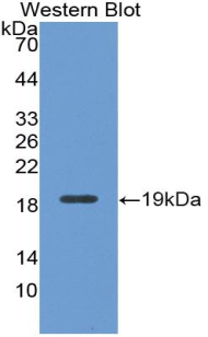 Polyclonal Antibody to Myeloperoxidase (MPO)