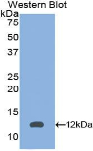 Polyclonal Antibody to Peroxisomal Biogenesis Factor 2 (PEX2)