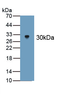 Polyclonal Antibody to Apolipoprotein <b>B100</b> (APO<b>B100</b>)