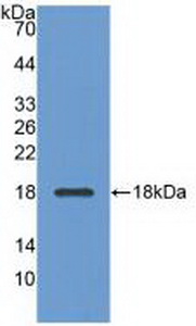 Polyclonal Antibody to Adiponectin (ADPN)