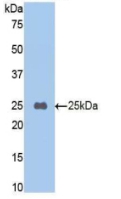 Polyclonal Antibody to Carboxypeptidase B2 (CPB2)