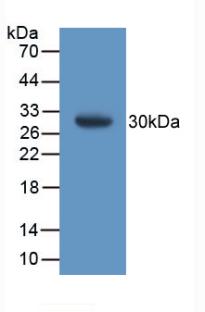 Polyclonal Antibody to Glutathione S Transferase Theta 1 (GSTt1)