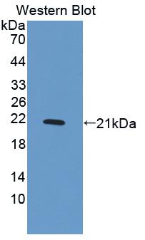 Polyclonal Antibody to Platelet Derived Growth Factor BB (PDGF BB)