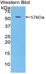 Polyclonal Antibody to Platelet Derived Growth Factor BB (PDGF BB)