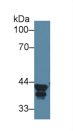 PAA642Hu01.jpg