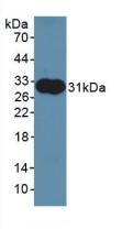 Polyclonal Antibody to Aldolase A, Fructose Bisphosphate (ALDOA)