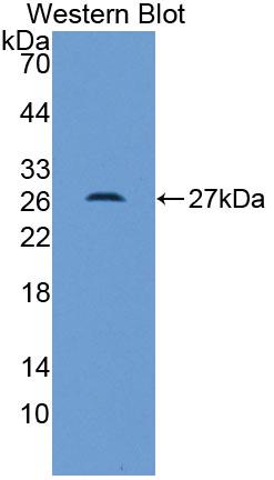 Polyclonal Antibody to Receptor For Advanced Glycation Endproducts (RAGE)