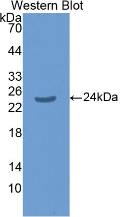 Polyclonal Antibody to Mothers Against Decapentaplegic Homolog 1 (Smad1)