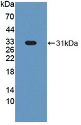 Polyclonal Antibody to Complement component 1 Q subcomponent-binding protein, mitochondrial (C1QBP)