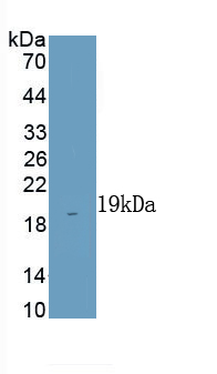 Polyclonal Antibody to Cluster Of Differentiation 28 (CD28)