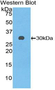 Polyclonal Antibody to Glutathione S Transferase Mu 3, Brain (GSTm3)