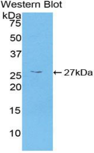 Polyclonal Antibody to Calcium/Calmodulin Dependent Protein Kinase II Gamma (CAMK2g)