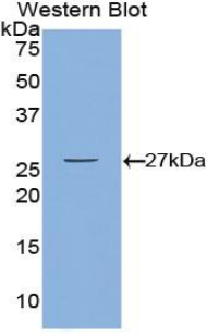 Polyclonal Antibody to Calcium/Calmodulin Dependent Protein Kinase II Gamma (CAMK2g)