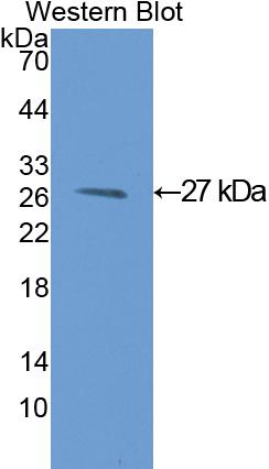 Polyclonal Antibody to Glutathione S Transferase Mu 1 (GSTM1)