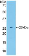 Polyclonal Antibody to Glutathione S Transferase A4 (GSTA4)