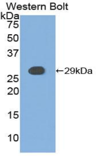Polyclonal Antibody to Casein Kinase 1 Alpha 1 (CSNK1a1)