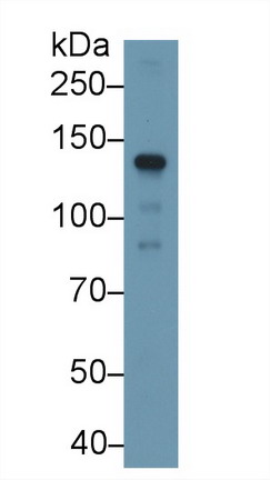 Polyclonal Antibody to Cross Linked C-Telopeptide Of Type I Collagen (CTXI)