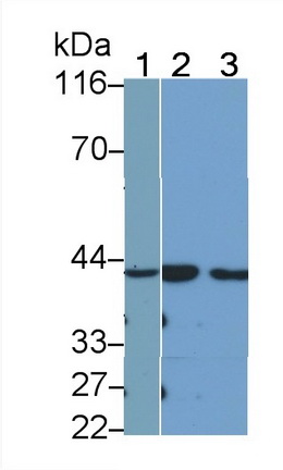 Polyclonal Antibody to Kallikrein 11 (KLK11)