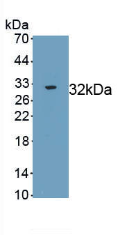 Polyclonal Antibody to Coagulation Factor XII (F12)