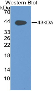 Polyclonal Antibody to Mucin 5 Subtype B (MUC5B)