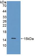 Polyclonal Antibody to Procalcitonin (PCT)