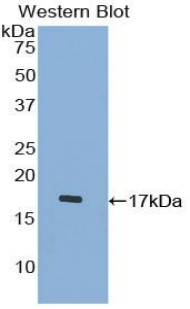 Polyclonal Antibody to Procalcitonin (PCT)