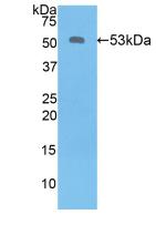 Polyclonal Antibody to Kallikrein 6 (KLK6)