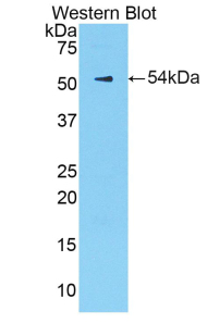 Polyclonal Antibody to Kallikrein 6 (KLK6)