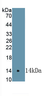 Polyclonal Antibody to Cyclooxygenase-2 (COX 2)