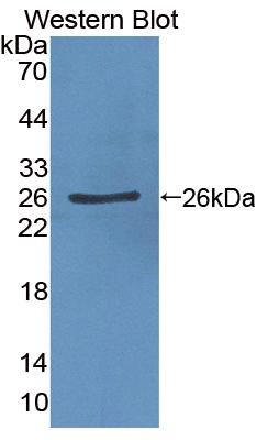 Polyclonal Antibody to Membrane Protein, Palmitoylated 6 (MPP6)