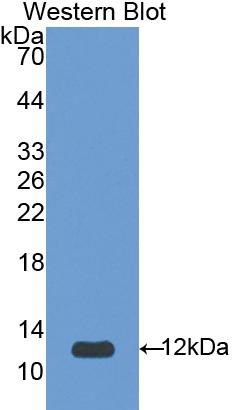 Polyclonal Antibody to Visceral Adipose Tissue Derived Serine Protease Inhibitor (Vaspin)