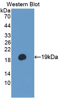 Polyclonal Antibody to Delta-Sleep Inducing Peptide (dSIP)