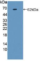 Polyclonal Antibody to Prothrombin Fragment 1+2 (F1+2)