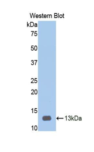 Polyclonal Antibody to Heparanase (HPSE)