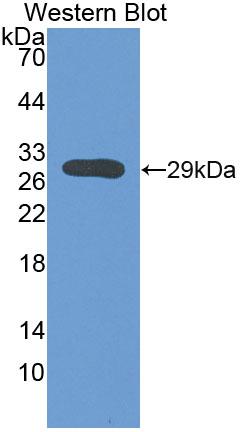 Polyclonal Antibody to Sodium/potassium Transporting ATPase Subunit Beta-3 (ATP1b3)