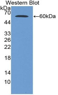 Polyclonal Antibody to Glucose-6-phosphate Dehydrogenase (G6PD)