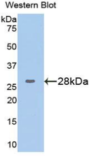 Polyclonal Antibody to Glucose 6 Phosphate Isomerase (GPI)