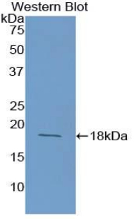 Polyclonal Antibody to Prealbumin (PALB)