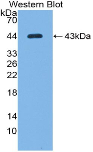 Polyclonal Antibody to Complement Component 7 (C7)