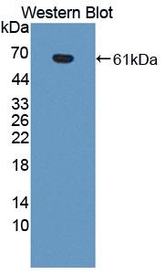 Polyclonal Antibody to Prostaglandin I Synthase (PTGIS)