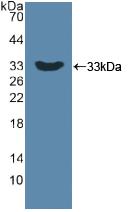 Polyclonal Antibody to Dickkopf Related Protein 1 (DKK1)