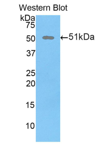 Polyclonal Antibody to Dickkopf Related Protein 1 (DKK1)