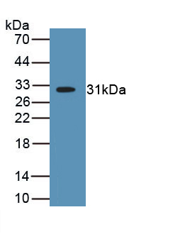 Polyclonal Antibody to Myosin Heavy Chain 2 (MYH2)