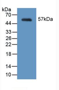 Polyclonal Antibody to Myosin Heavy Chain 2 (MYH2)