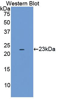 Polyclonal Antibody to Epidermal Growth Factor Receptor (EGFR)