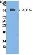 Polyclonal Antibody to Complement C3 Convertase (C3 Convertase)