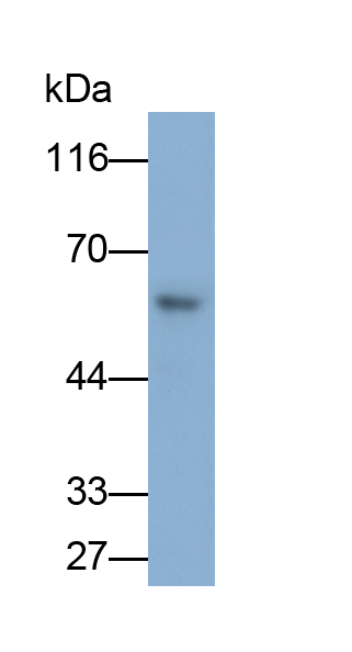 Polyclonal Antibody to Forkhead Box Protein P1 (FOXP1)