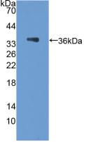 Polyclonal Antibody to Podocalyxin (PODXL)